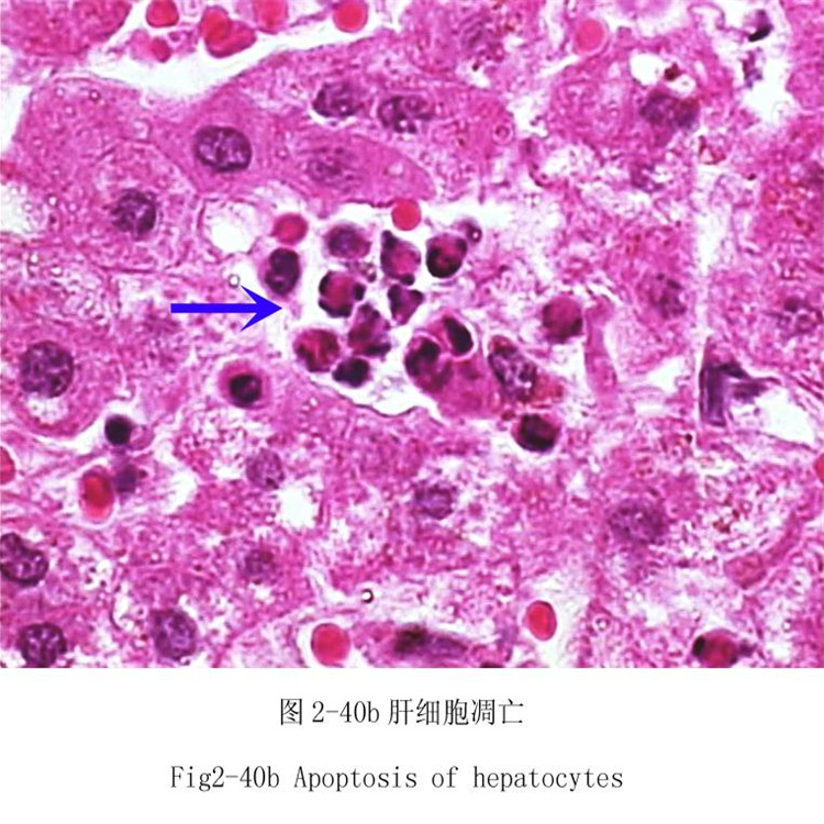 肝細(xì)胞凋亡
