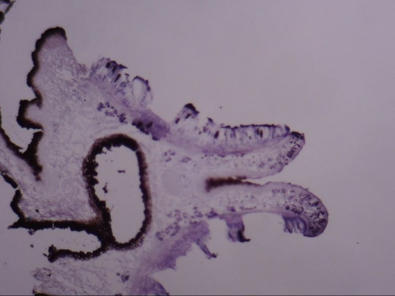 地衣子囊盤切片
